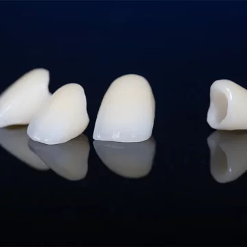 Why Dental Crowns Are Essential in Restorative Dentistry